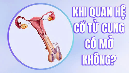 Khi quan hệ cổ tử cung có mở không? Bác sĩ giải thích